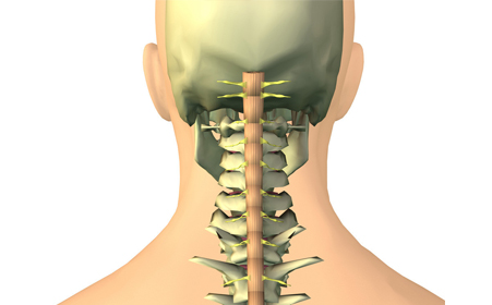 什么是颈椎间盘突出？